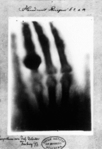 Hand mit Ringen (Mano con anillos): impresión de la primera radiografía "médica" de Wilhelm Röntgen, de la mano de su esposa, tomada el 22 de diciembre de 1895 y presentada a Ludwig Zehnder del Instituto de Física de la Universidad de Friburgo, el 1 de enero de 1896