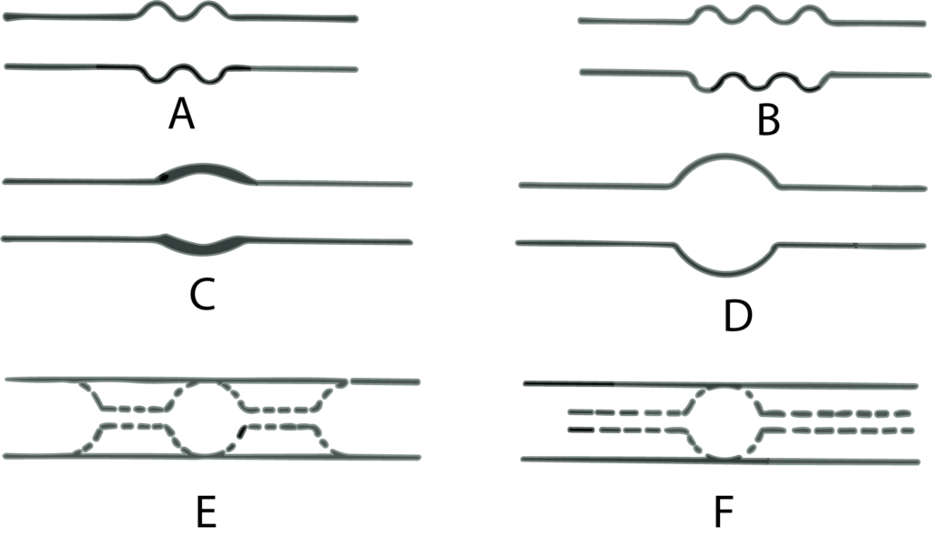 Fig 13. Formación de un bulbo en la mitad de un tubo