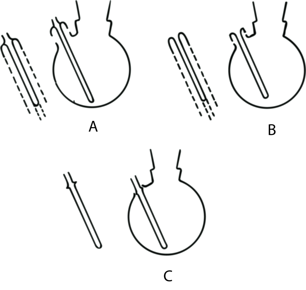 Figura 1. Tres m&eacute;todos de sellado de pozos termom&eacute;tricos en matraces.
